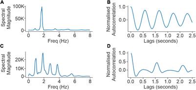 Accuracy of Step Count Estimations in Parkinson’s Disease Can Be Predicted Using Ambulatory Monitoring